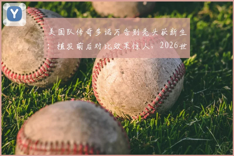 美国队传奇多诺万告别秃头获新生:植发前后对比效果惊人,2026世界杯观战新发型成焦点讨论